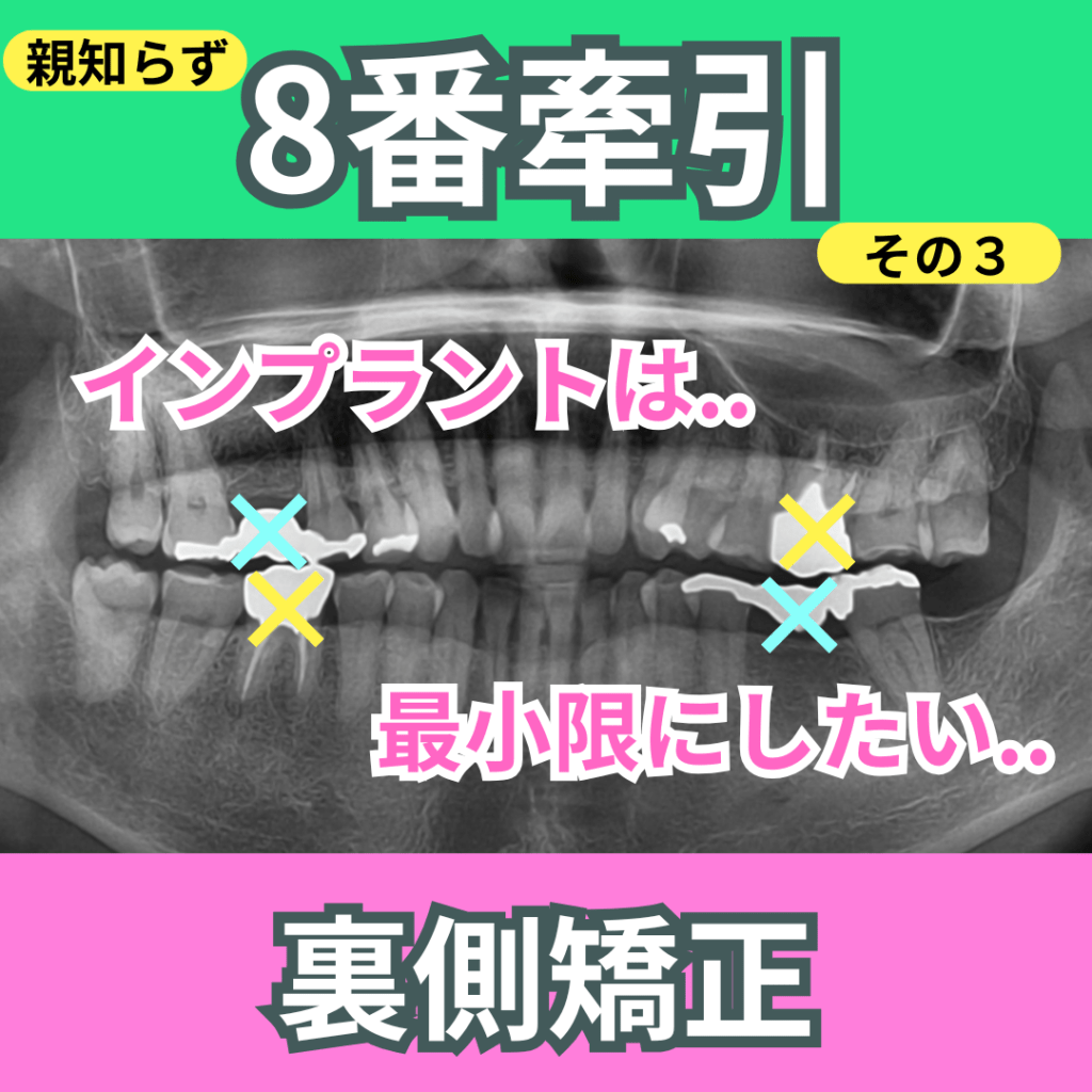 8番の牽引（インプラント併用）