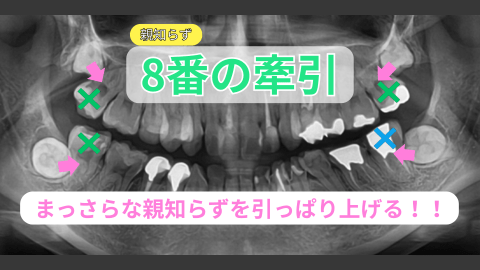 試し動画003 – ８番牽引サムネイル – 480x270