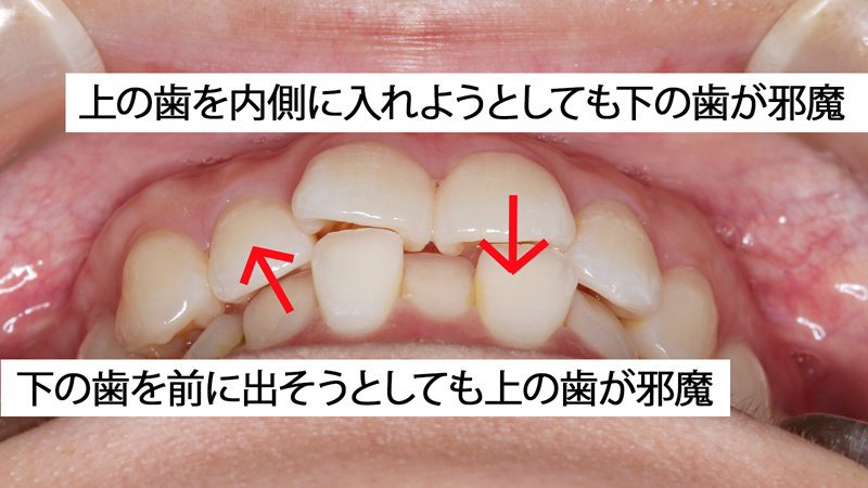 注意点